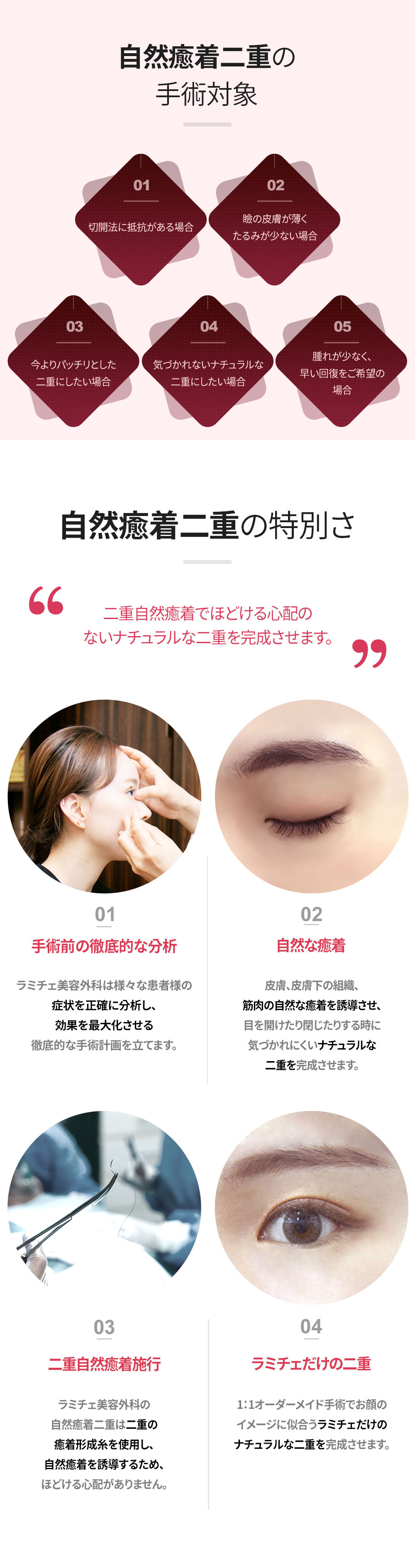 Lamiche Plastic Surgery 自然癒着二重